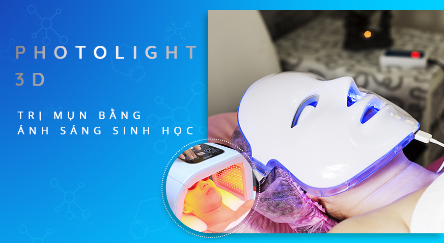 hinhchinh-TRỊ-MỤN-BẰNG-ÁNH-SÁNG-SINH-HỌC